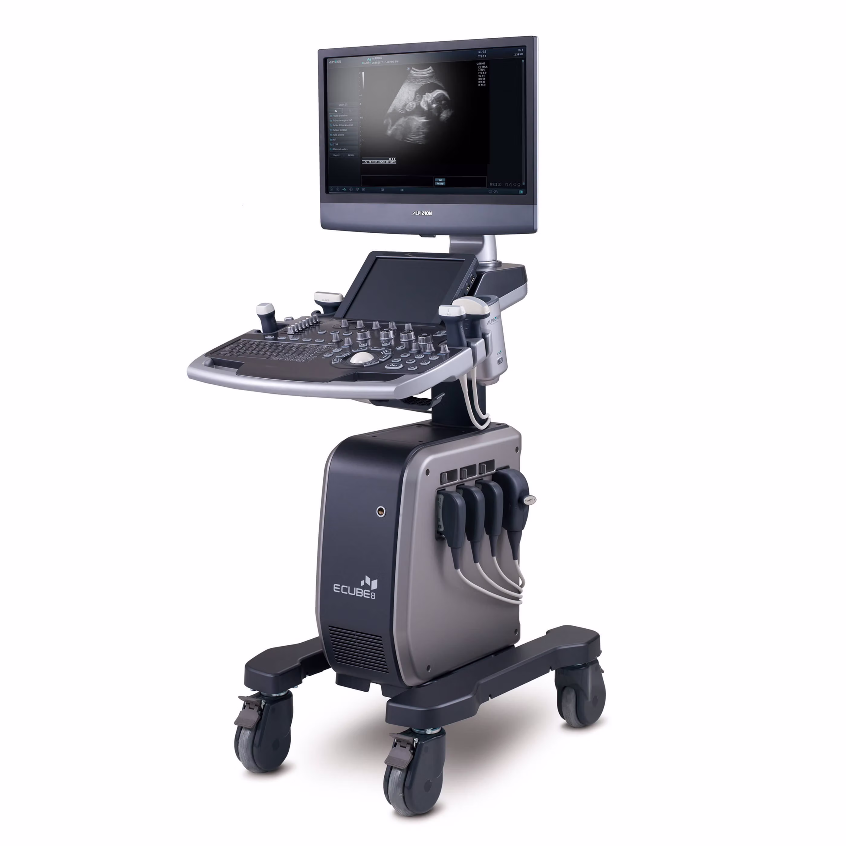 Ultrasonido Doppler color ALPINION E-CUBE 8 Diamond